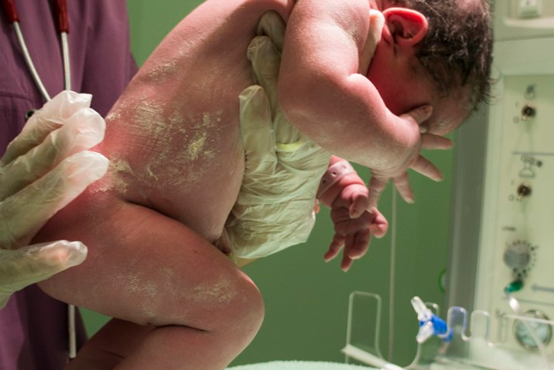 parto humanizado e viol&ecirc;ncia obst&eacute;trica kambai